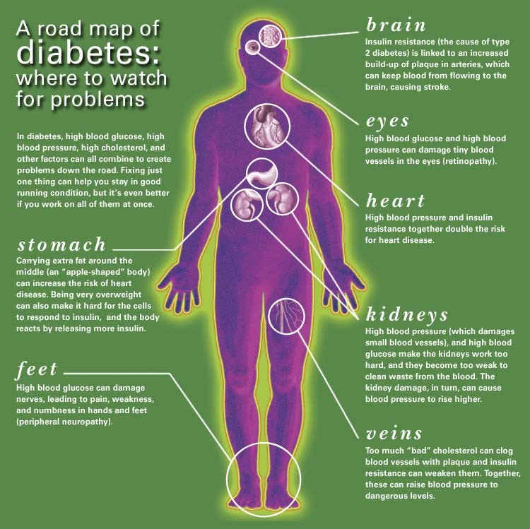 Complications of Diabetes Mellitus